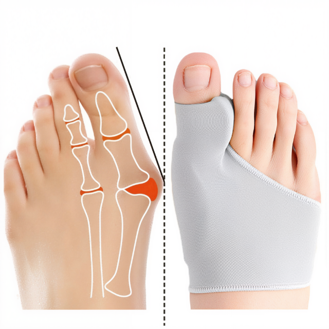 Bunion Corrector mit Gelpad für Zehenkorrektur