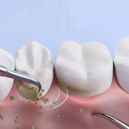 Verktøy for fjerning av tannstein og plakk